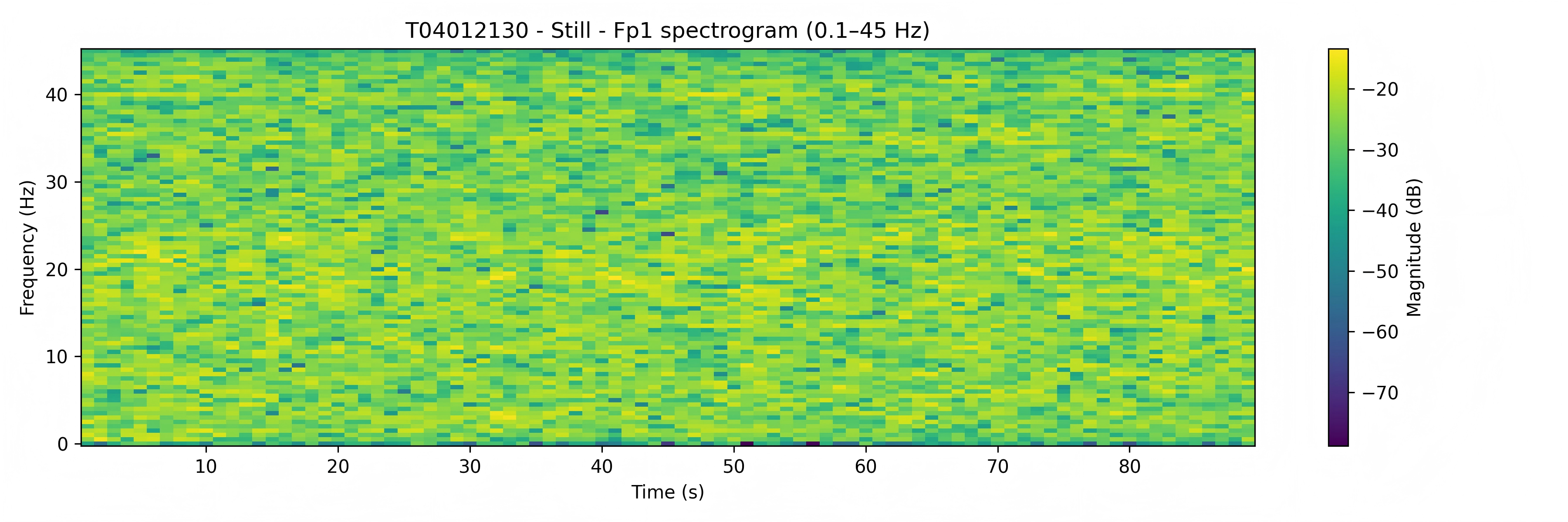 Time-Frequency EEG